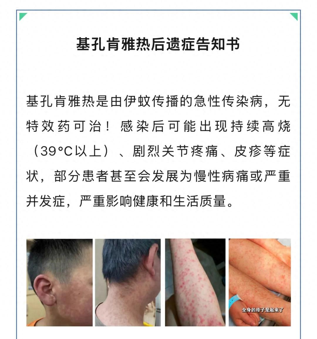 基孔肯雅熱患者會痛一輩子?專家回應